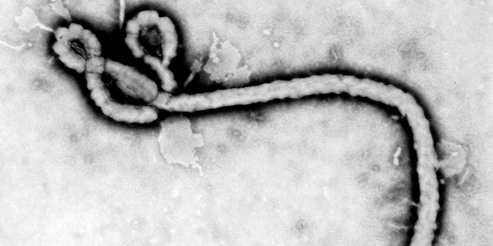 Speciale Ebola #1: che cos'è?
